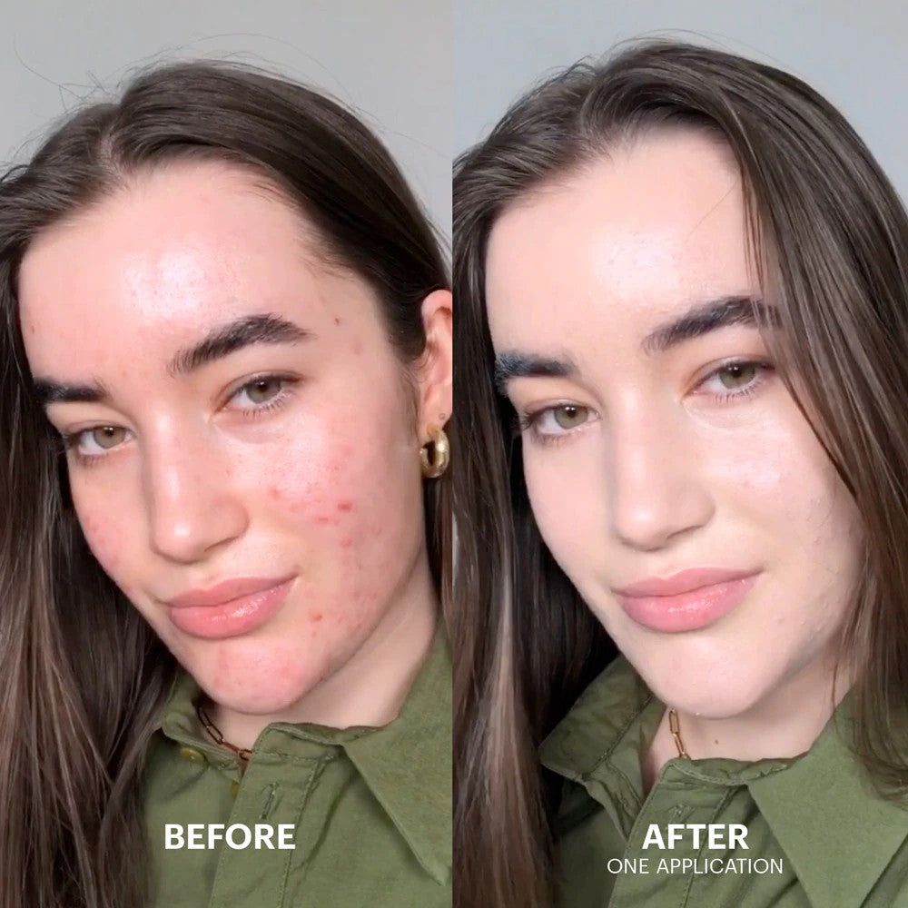 Dr. Jart+ - Cicapair Tiger Grass Color Correcting Treatment - 50ML