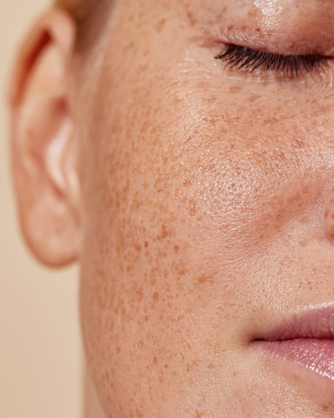 DARK SPOTS & PIGMENTATION
