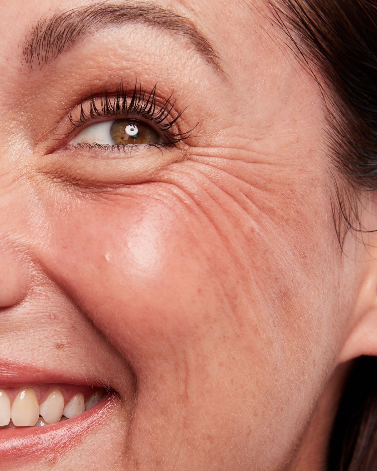 AGING & WRINKLES