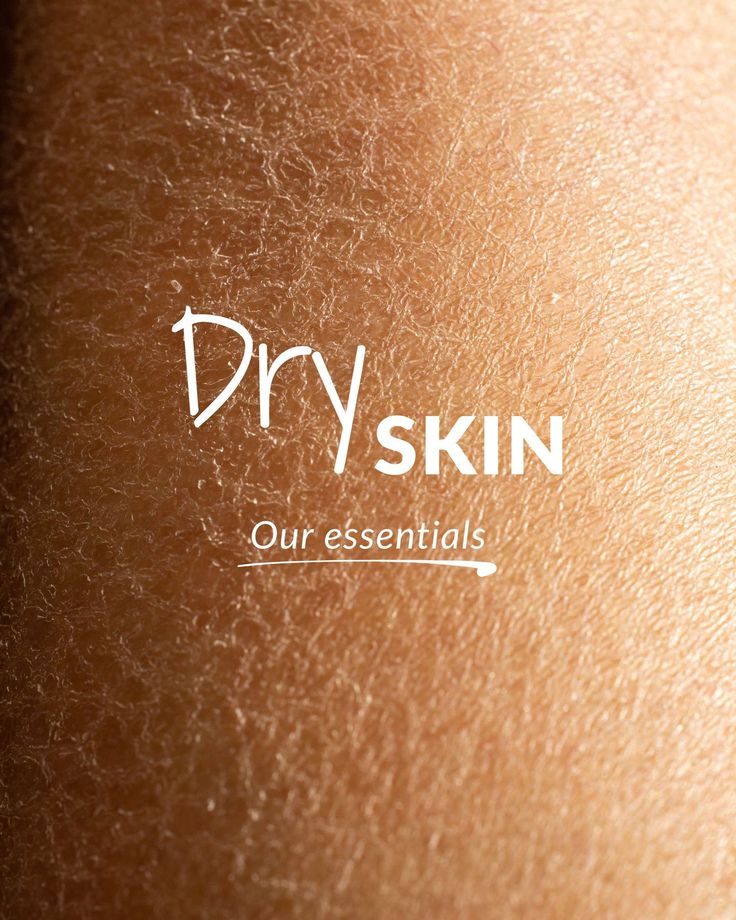 DRY & DULL SKIN
