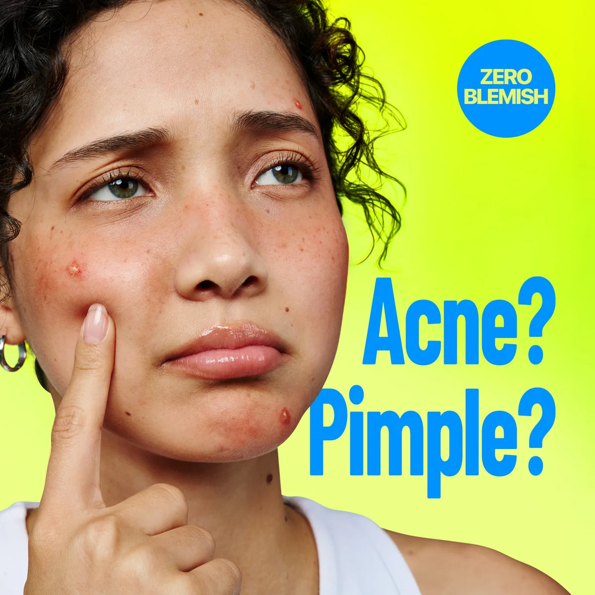 NUMBUZIN Zero Blemish 3X Spot Cream applied to a blemish on the cheek