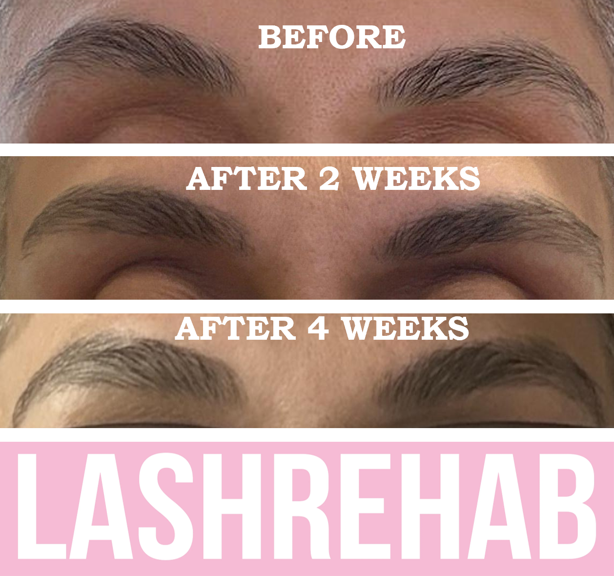 LASH REHAB - Brow Growth Serum - 3ML