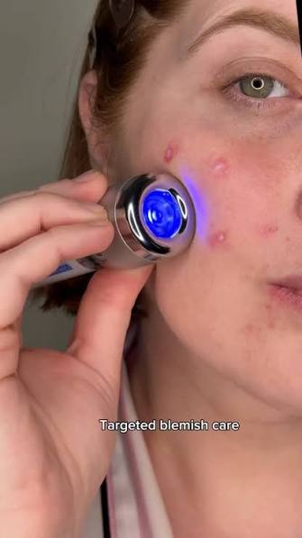 CELLOLOGY -  Blue Eraser Serum - 15ML (LED)